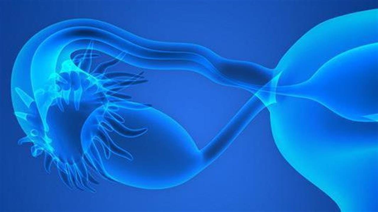 Ερευνητές αναπτύσσουν γρήγορο τεστ για τον καρκίνο των ωοθηκών